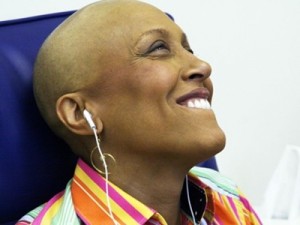 robin-roberts bald