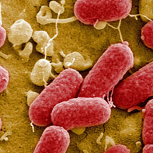 E.coli Scare Is a PR and Marketing Nightmare for Trader Joe's